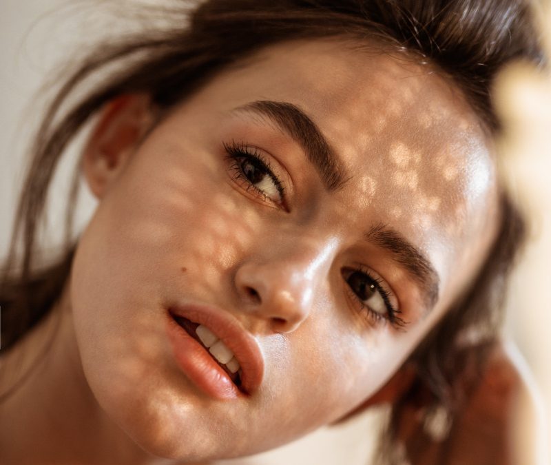 Quand la peau nous joue des tours